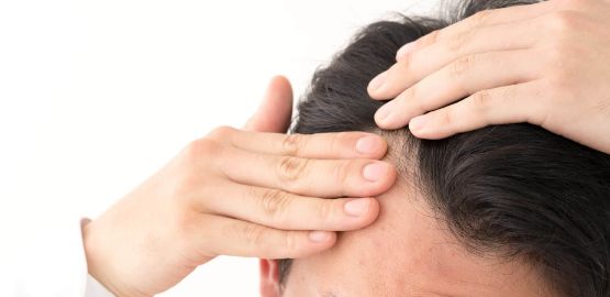 髪の毛のお悩み